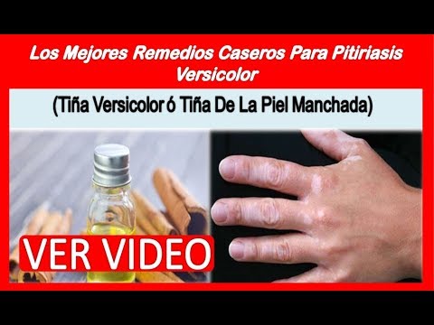 Tratamientos naturales para tina versicolor